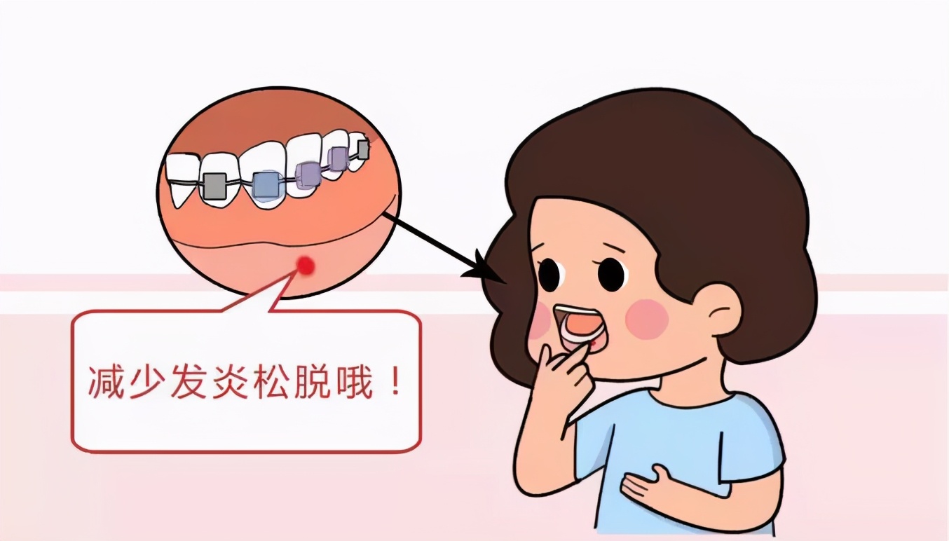 大连齿医生口腔补牙洞视频,口腔正畸打骨钉动画演示