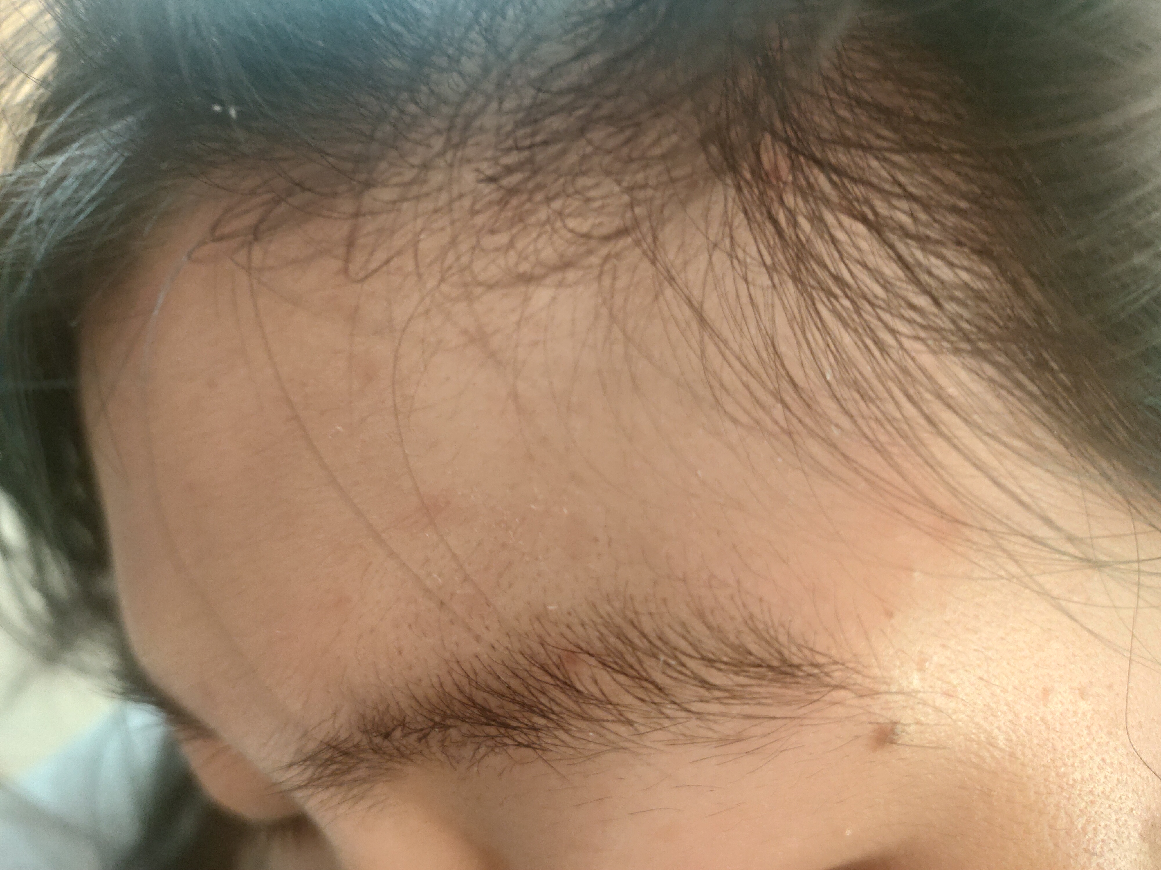 想要嬛嬛同款“舒痕胶”？这个，可以有