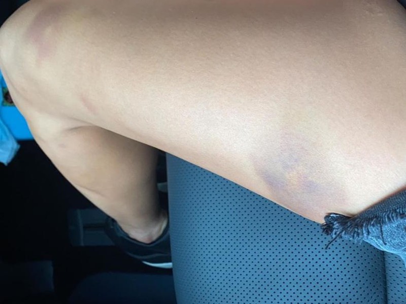 外卖小哥脚被车撞了,外卖小哥被车撞了急着走