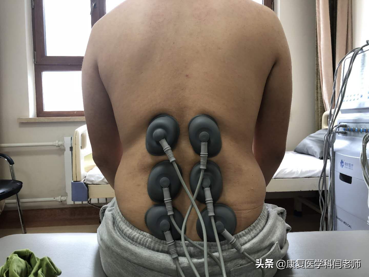 康复理疗中频治疗,中频电疗仪对偏瘫康复的作用