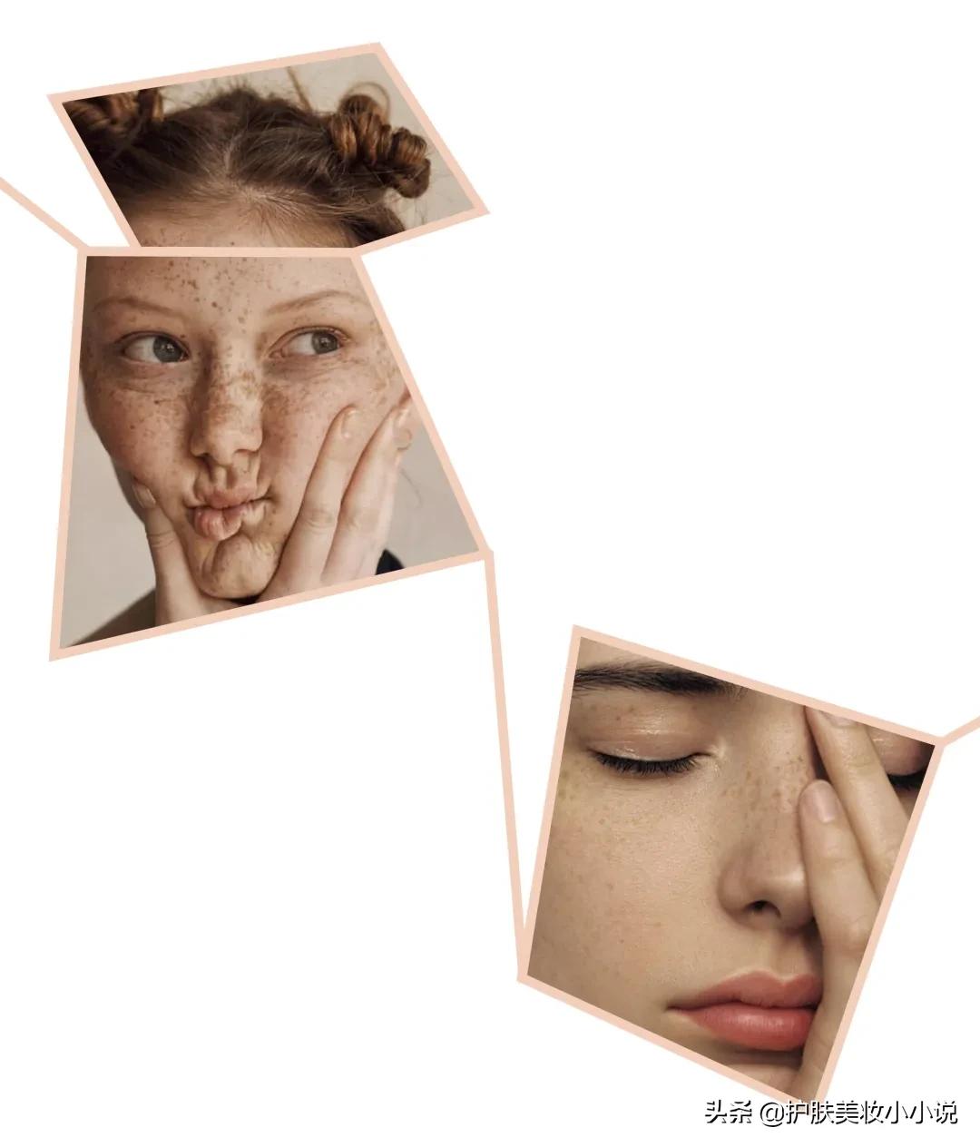 脸上有斑该怎么选护肤品呢,干性皮肤长斑的护肤步骤