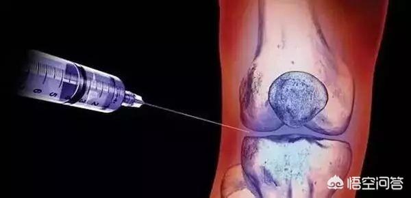 关节炎可以通过打抗生素治疗吗,关节炎治疗的注意事项