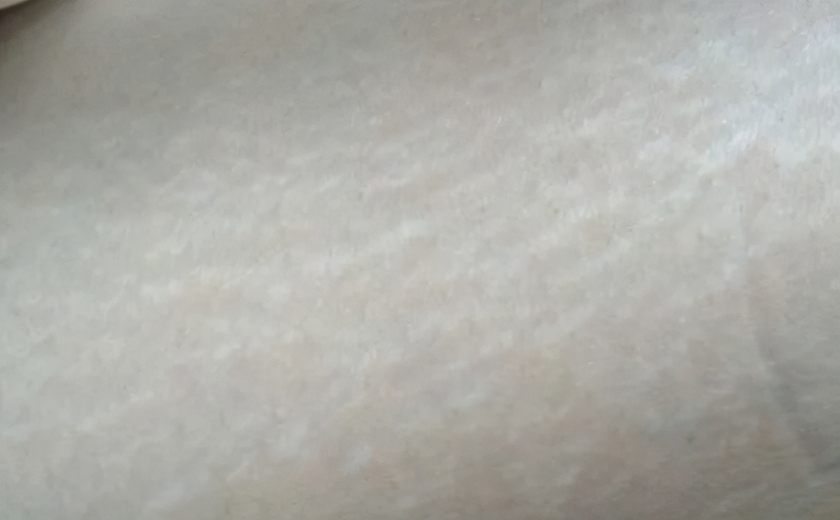 屁屁不红疼是怎么回事,屁屁凹凸不平如何改善