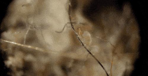 床垫除尘除螨虫多少钱,床垫螨虫怎么彻底消灭