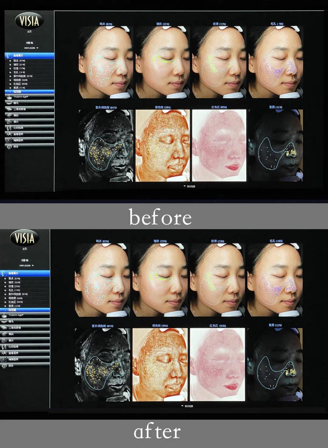 美肌‖他们要怎么做，才能让肤质显好不显老？