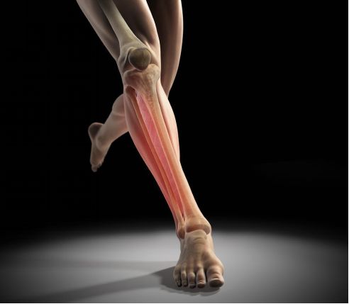 小白跑步容易伤哪个部位,初跑者小腿酸痛怎么办