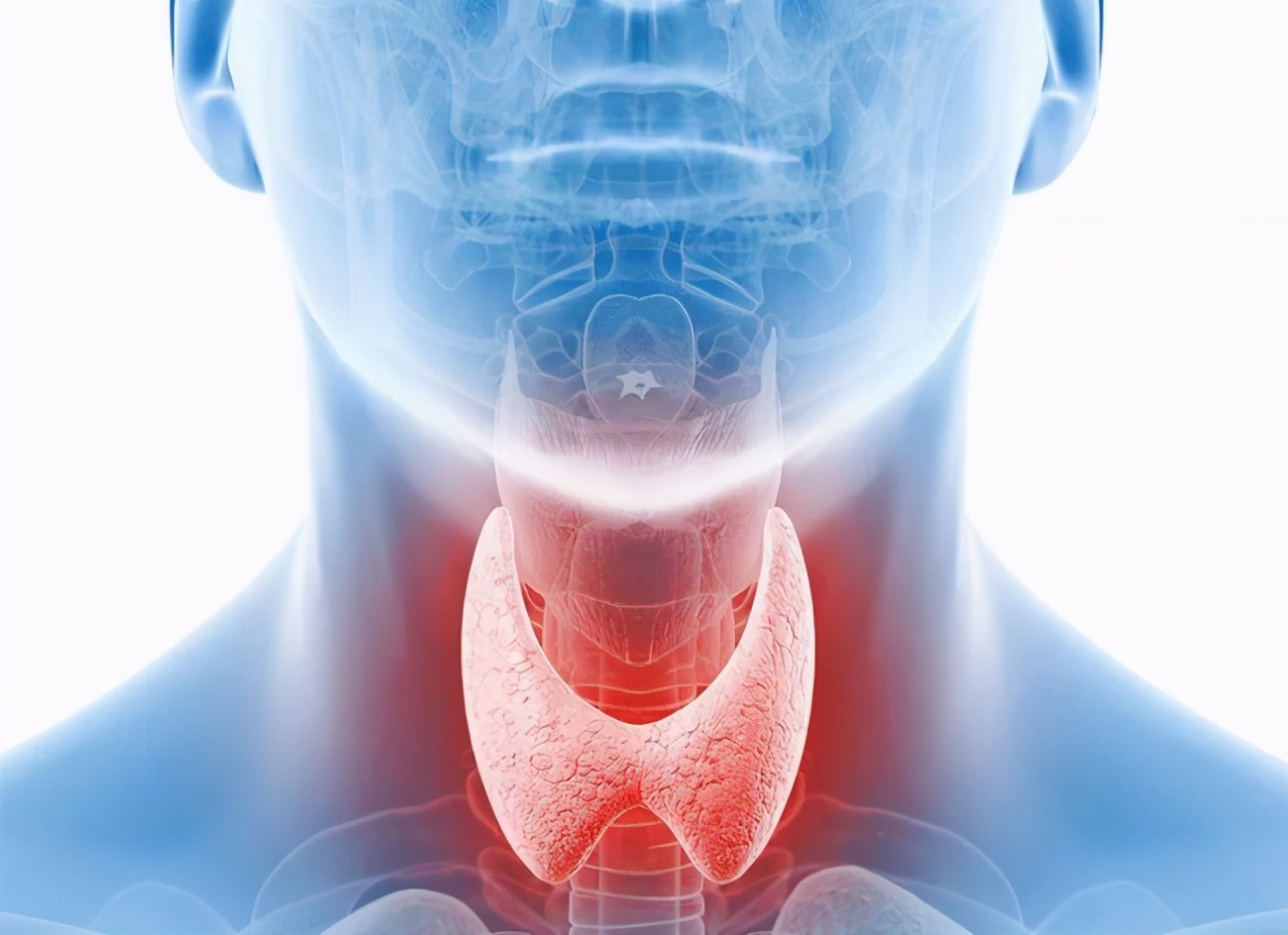 脖子粗斜方肌不对称,脖子粗大和甲状腺结节的区别