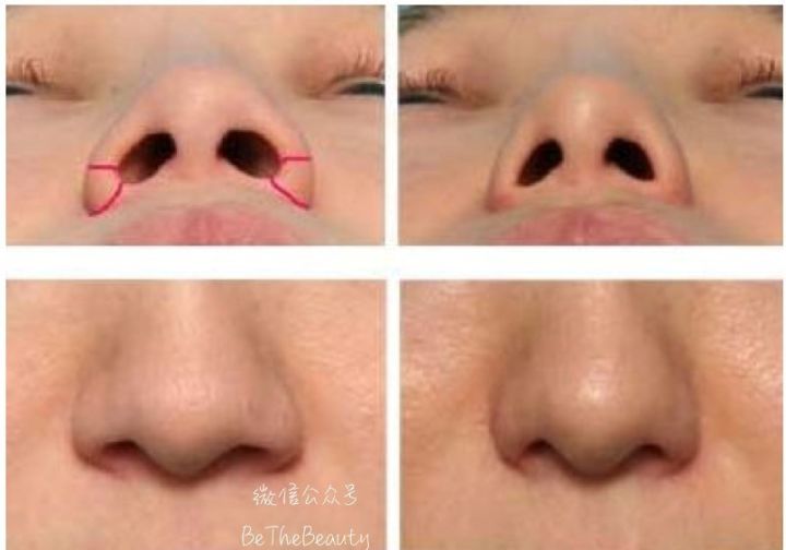 鼻梁很塌怎么画修容,塌鼻子大鼻头怎么画鼻影