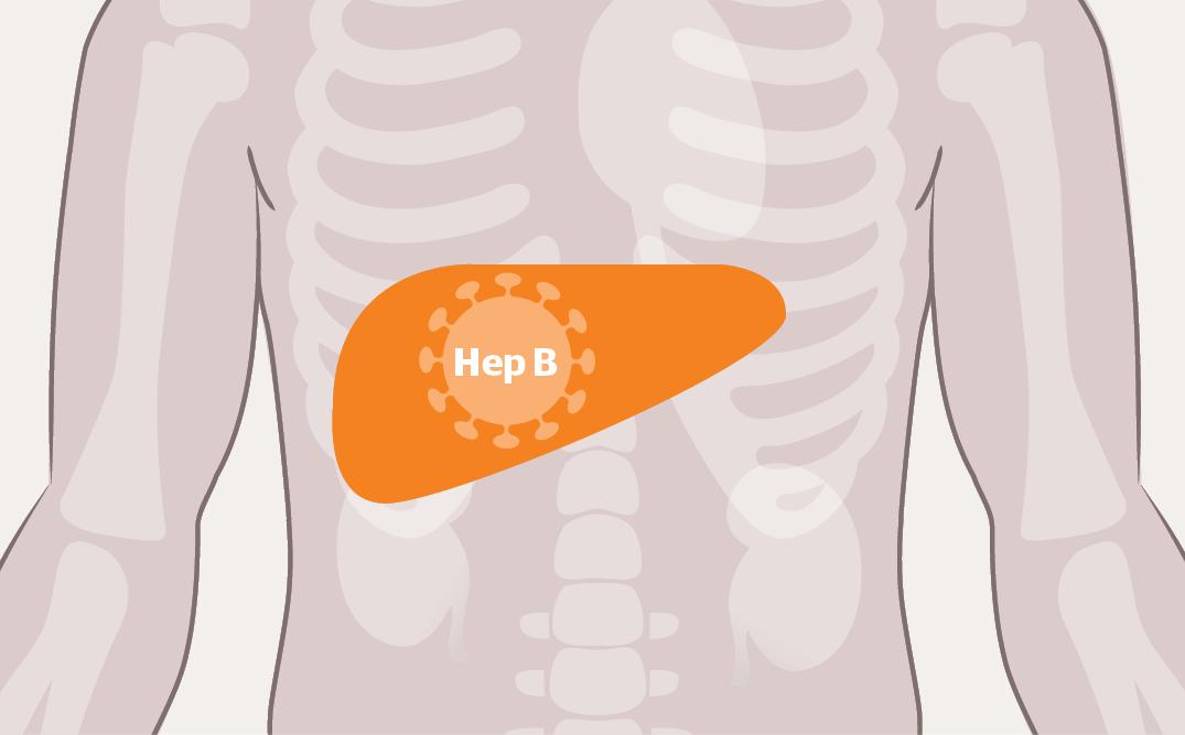 医生，我有乙肝大三阳，吃点什么药？慢性乙肝抗病毒治疗简明指南