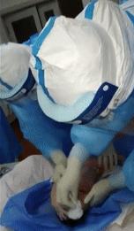 孕妇确诊新冠有没有后遗症,孕期确诊新冠肺炎孩子能要么