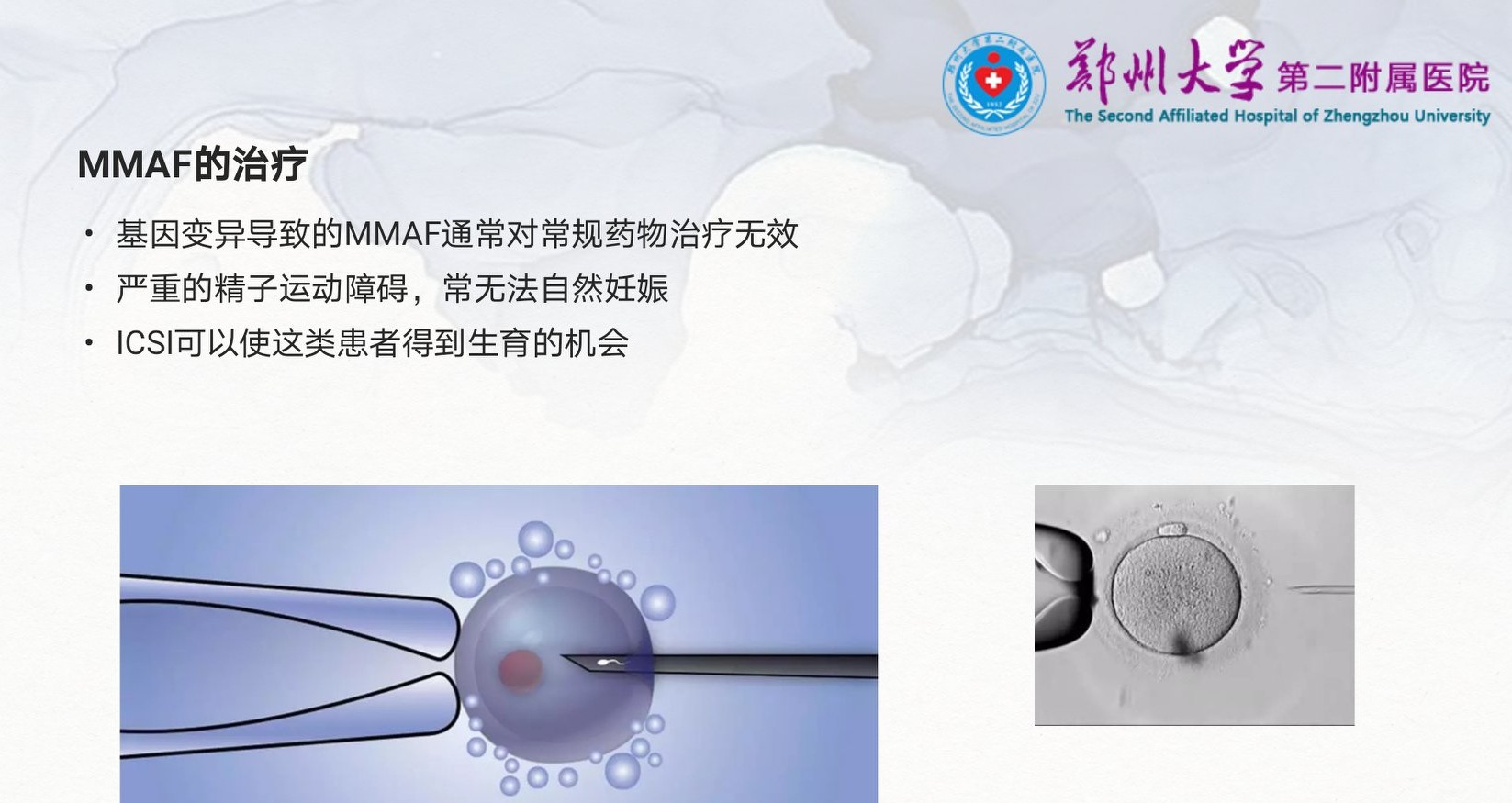 严重弱精症和完全无活动精子的原因是啥？