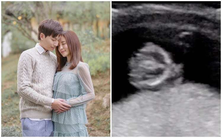 棣欐腐鐭ュ悕姝屾墜鍙戠儳鍏ラ櫌,鎰熸煋鑲虹値棣欐腐鑹轰汉