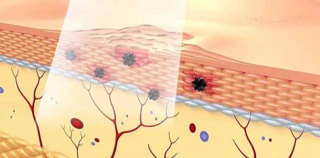 打完玻尿酸和瘦脸针的注意事项,打完玻尿酸和瘦脸针应该注意什么