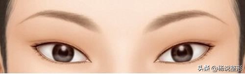 整形医生科普割双眼皮必看攻略,割双眼皮一定好看吗