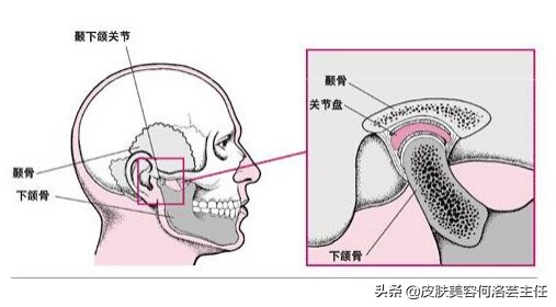 日式小颜整骨术靠谱吗,小颜整骨会有后遗症吗