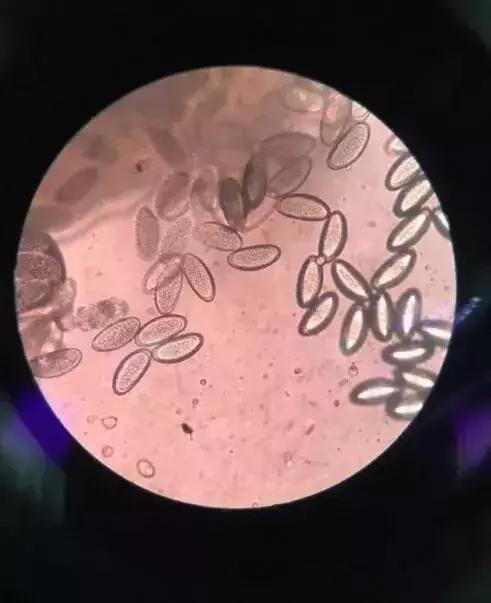 4岁小女孩老喊屁屁痒，妈妈脱下她裤子后惊呆：许多小虫子！还在动