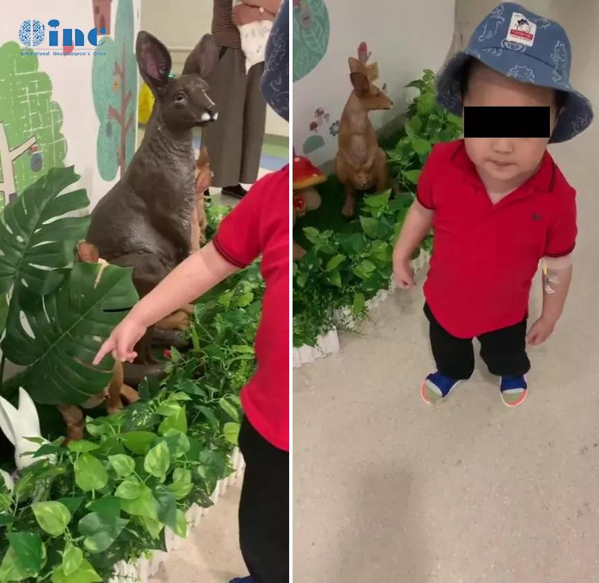 如何治疗小儿脑瘤,治疗脑胶质母细胞瘤