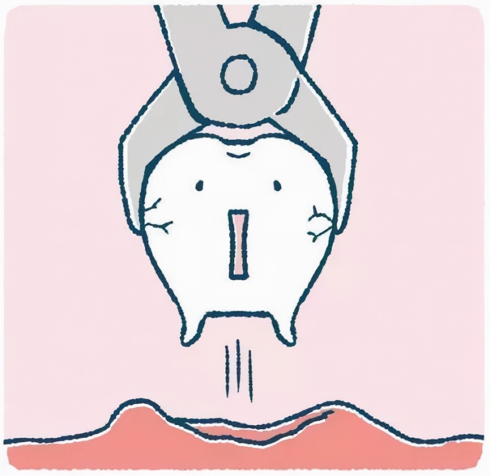 智齿为什么老是发炎,智齿为什么要尽早拔掉