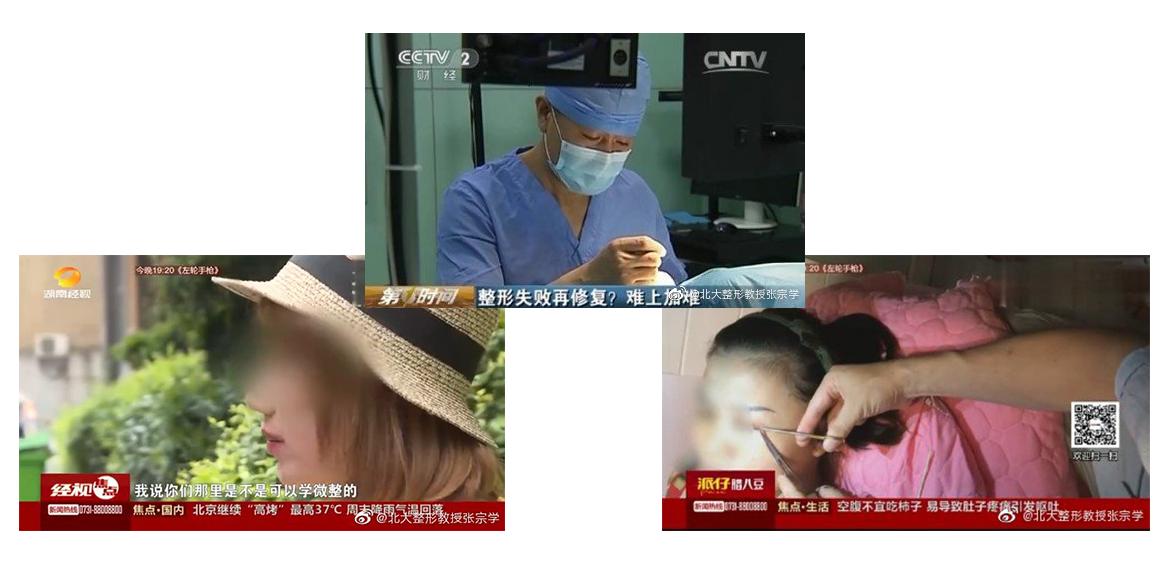 那些绝美的双眼皮手术,2022年最流行的双眼皮技术是哪个