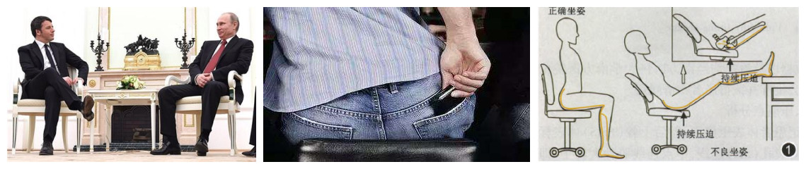 屁股痛、腿麻,有块肌肉受伤了