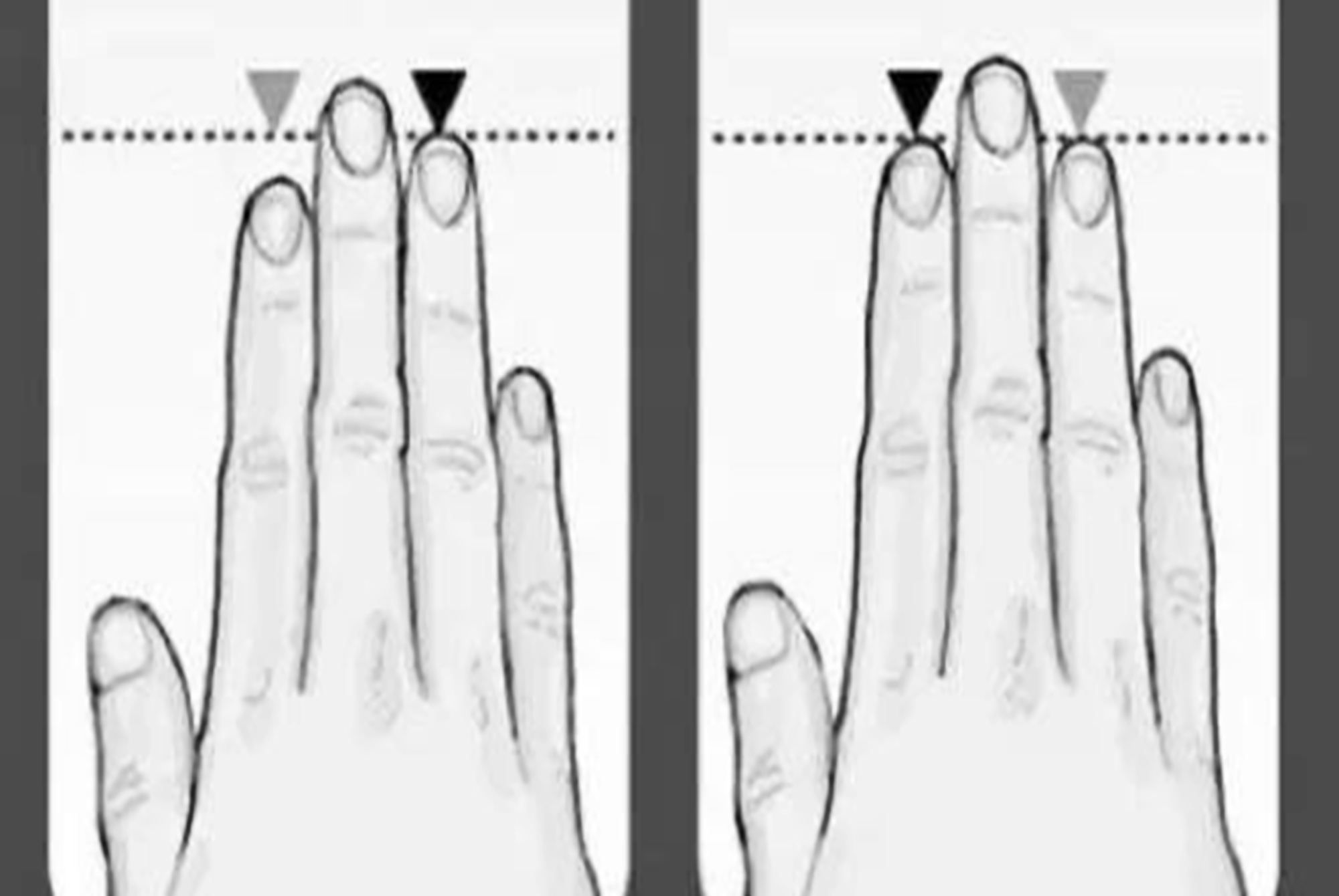 食指跟无名指长度相差不大,食指跟无名指长度一样代表什么