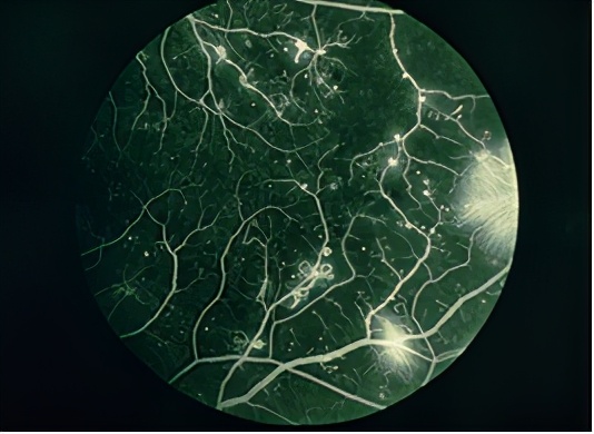 nature重磅揭秘人类抗击糖尿病历史,nature十大科学进展