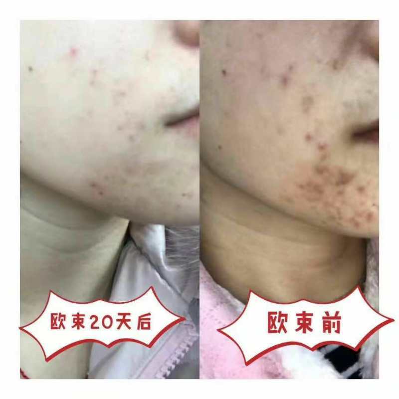 欧束测评结果,欧束还能用吗