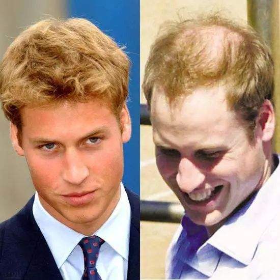 秃头少女拯救世界,秃头女孩的救命方法