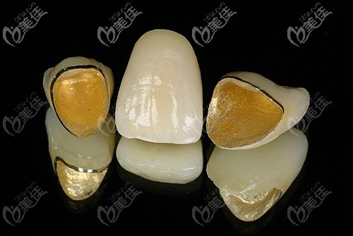 3d打印烤瓷牙技术视频,3d打印烤瓷牙的优缺点