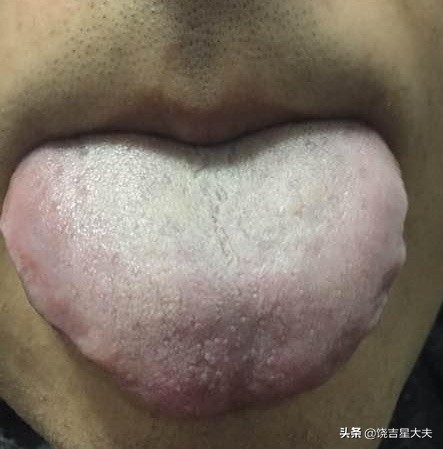 中医晚上口渴老想喝水什么原因,老中医告诉你一到晚上就口干