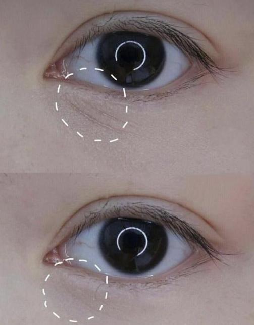 戚薇力荐的眼霜,用后黑眼圈细纹都没了,李佳琦:确实不错