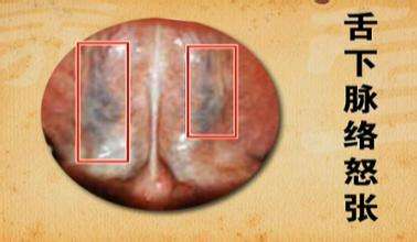 经脉和络脉的区别,经脉与络脉如何区别