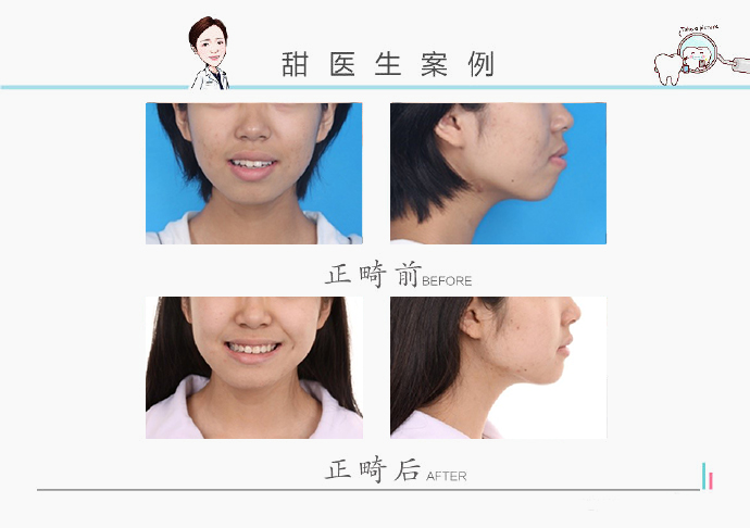 西安哪里有做牙齿矫正,在西安哪里可以做牙齿矫正