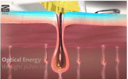 夏天穿毛衣毛裤好吗,夏天毛衣毛裤