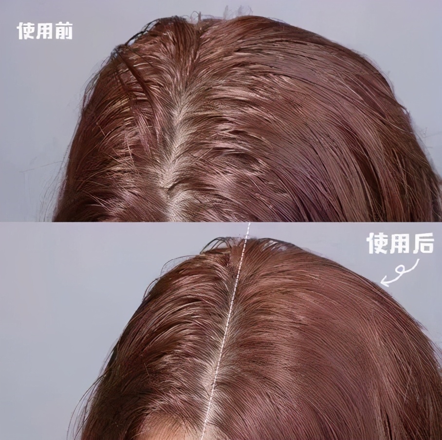 头发爱出油用什么可以变蓬松,头发油怎么才能头发蓬松干爽