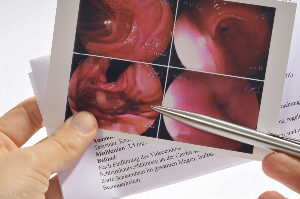 无痛胃镜和胶囊胃镜哪个比较好,胃镜检查是无痛胃镜还是普通的好