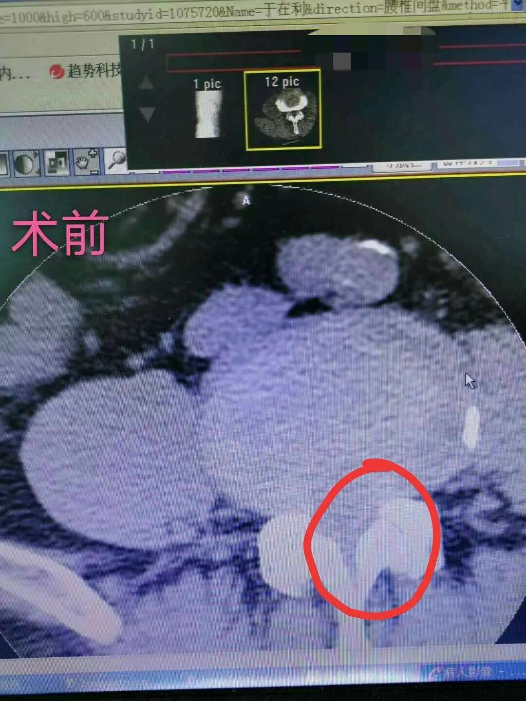 玉田县医院骨科,玉田县中医医院骨一科专家