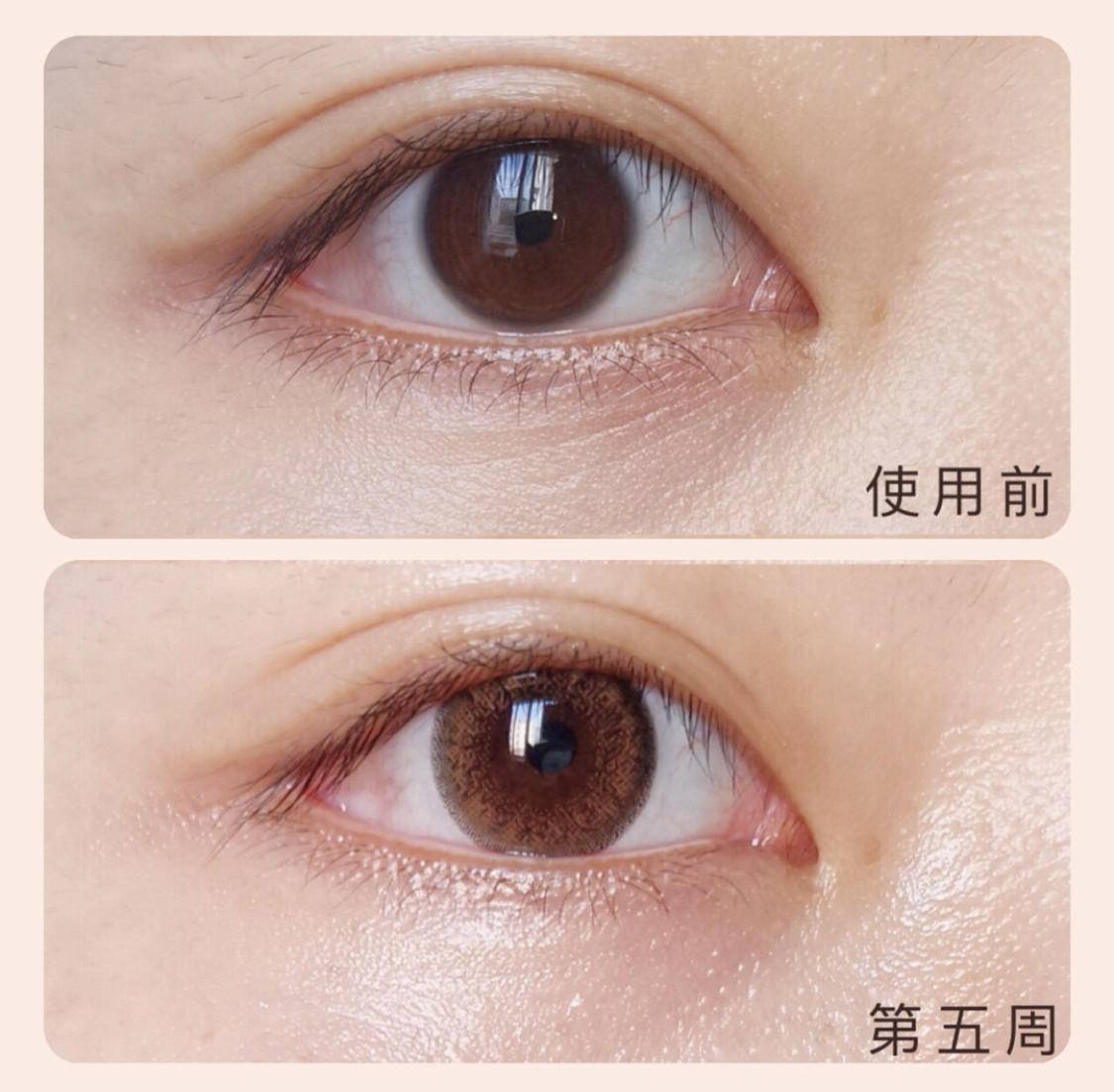 有句话说得好:美不美看脸,老不老看眼