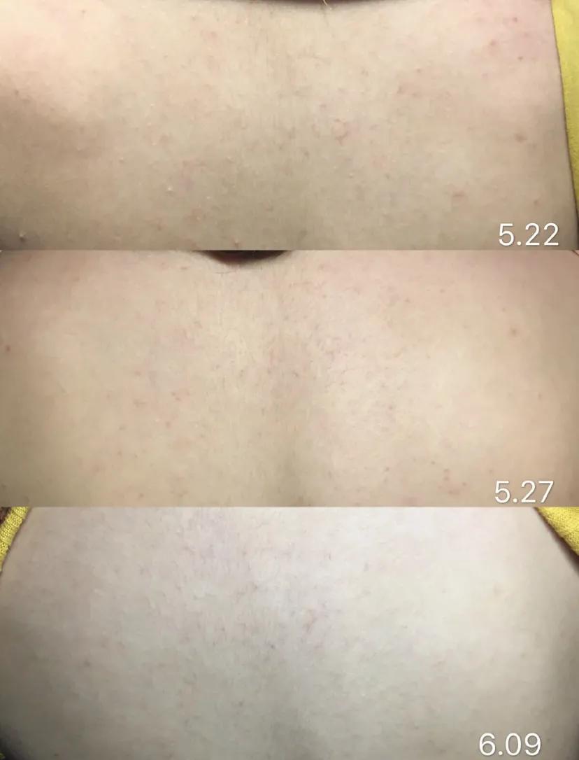 浜斿崄鍏冨氨鑳戒拱鍒扮殑蹇箰,19鍏冨氨鑳戒拱鍒扮殑蹇箰