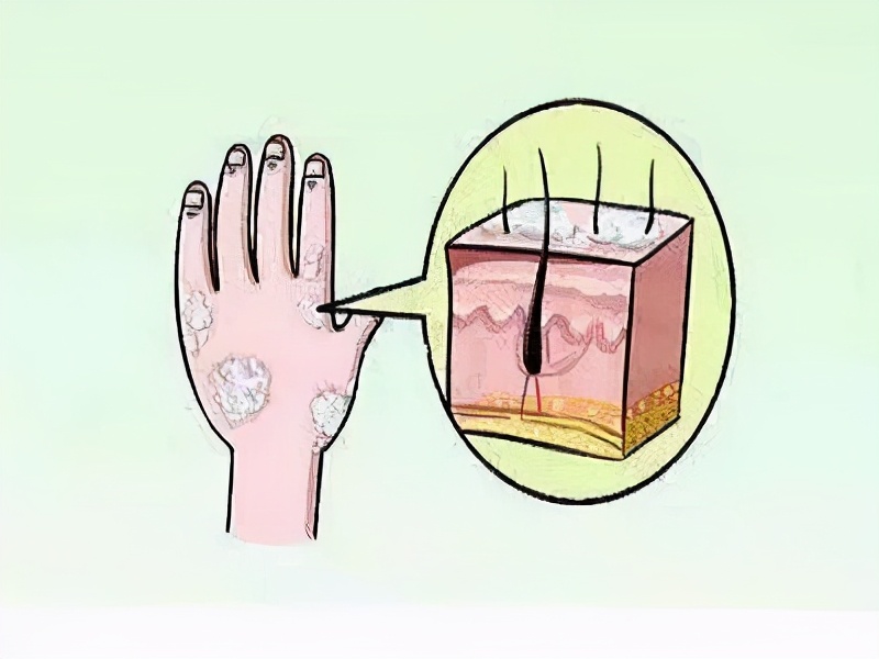 冬季膏方节,养生膏方节活动