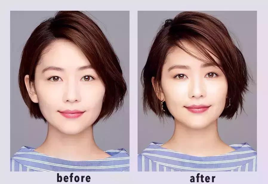 日本小脸矫正手法,日本小脸整形手术