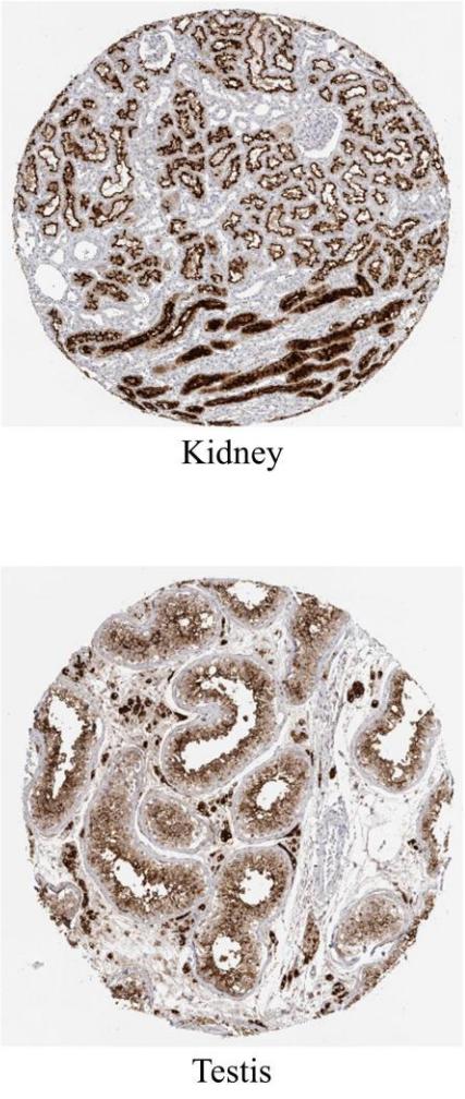 新型冠状病毒攻击肾脏睾丸,新研究揭示新冠病毒如何影响心脏