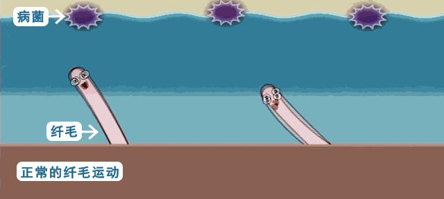 换季慢阻肺气喘怎么办,春季换季咳嗽最快治愈方法