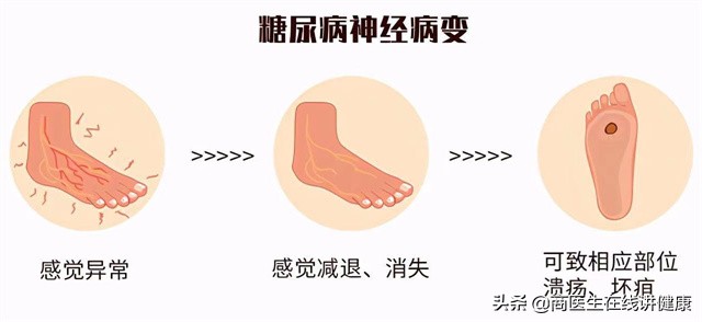 甲钴胺片是治疗神经最好的药物吗,甲钴胺片是营养神经的扛把子