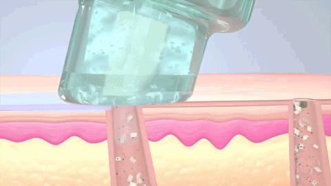 小气泡美容优惠券,小气泡美容护肤团购附近