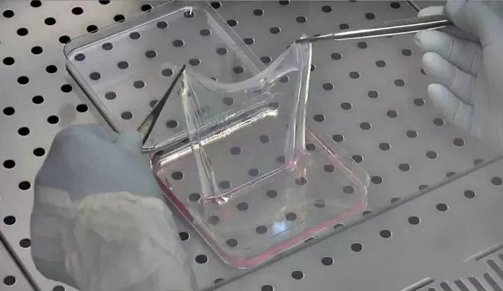 造血干细胞重获新生,神奇的干细胞让他们重获新生