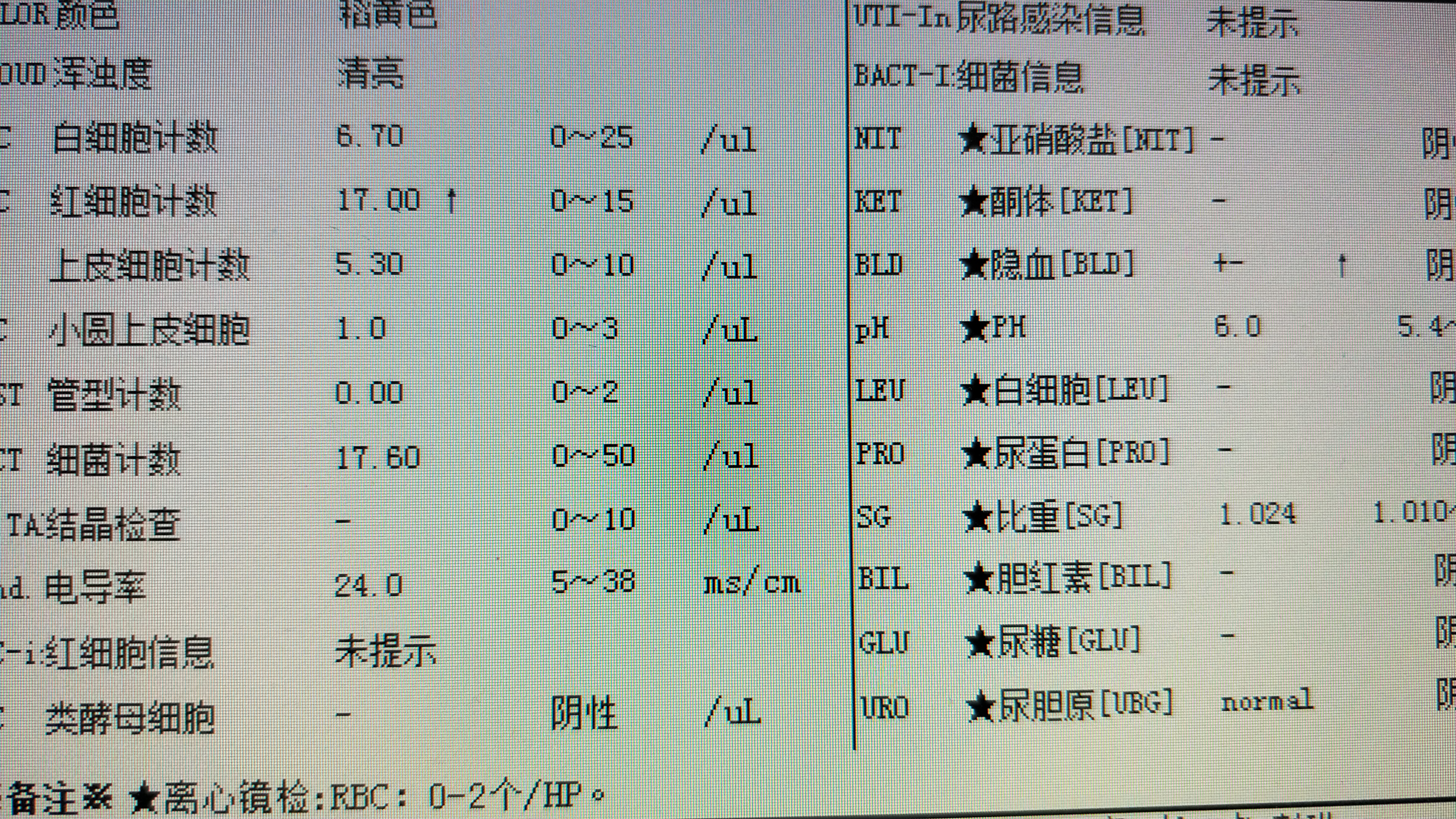 发现尿潜血,发现尿潜血后需要做哪些检查