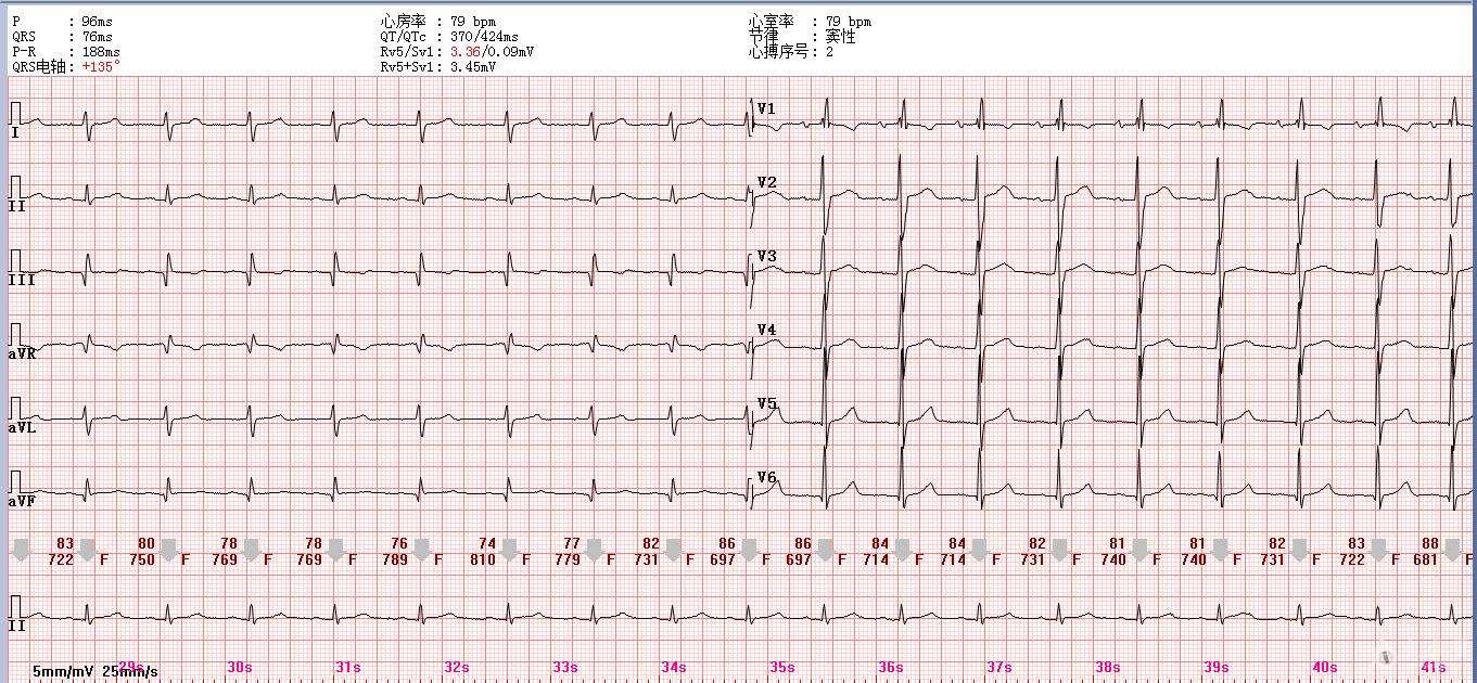 体检查出心脏供血不足，该怎么办呢？