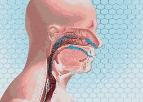 肺气肿慢阻肺肺心病,慢阻肺肺气肿的最佳治疗方法