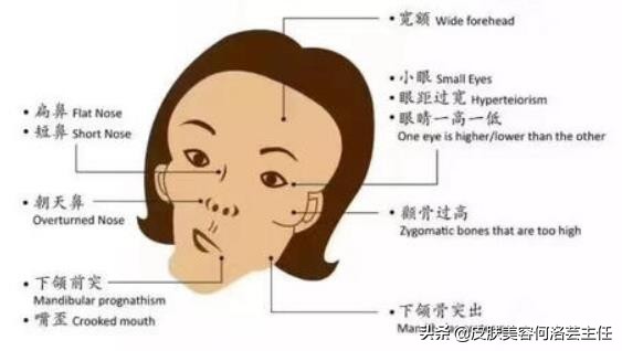 日式小颜整骨术靠谱吗,小颜整骨会有后遗症吗